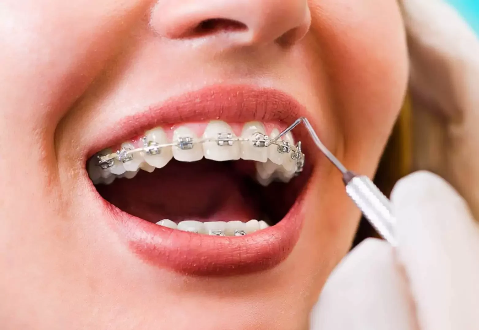 oraldoctor-ortodontia-min